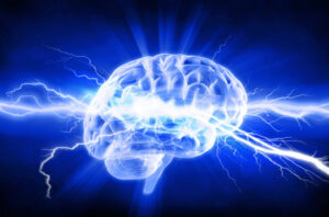 Cerebro